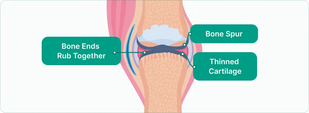  damaged joint