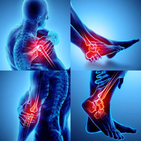 FlexiEase™ Joint pain illustration